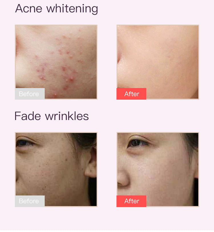 SQ10 | Full-Face Color Ritual Mask Multi-LED 8-Color LED Face Mask