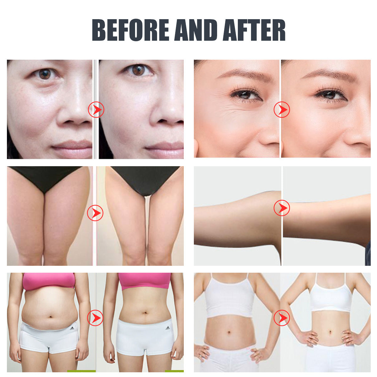 SQ47B Pro, 6in1 40K Cavitation Body Sculpting Device, Multi-Polar RF Vacuum EMS Laser for Body Contouring, Skin Smoothing & Face Skin Firming