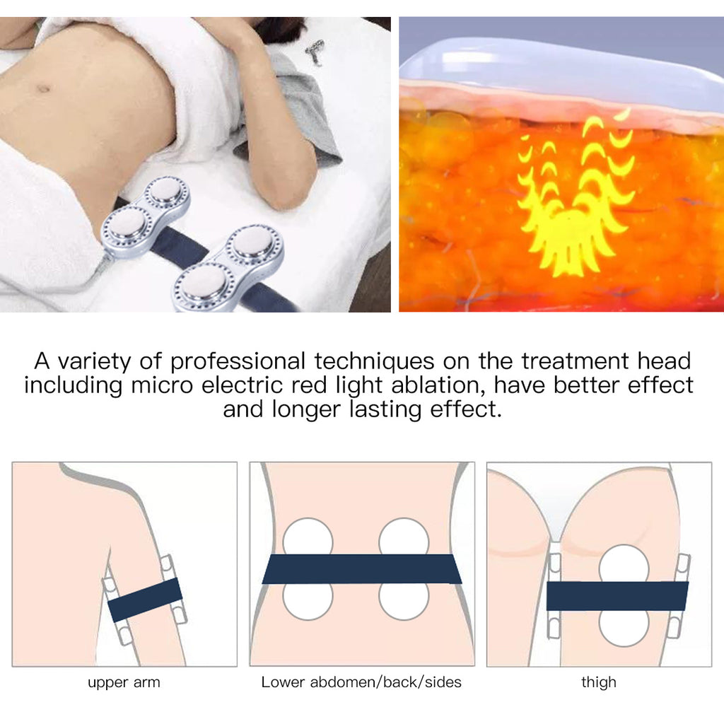 SQ47B Pro, 6in1 40K Cavitation Body Sculpting Device, Multi-Polar RF Vacuum EMS Laser for Body Contouring, Skin Smoothing & Face Skin Firming