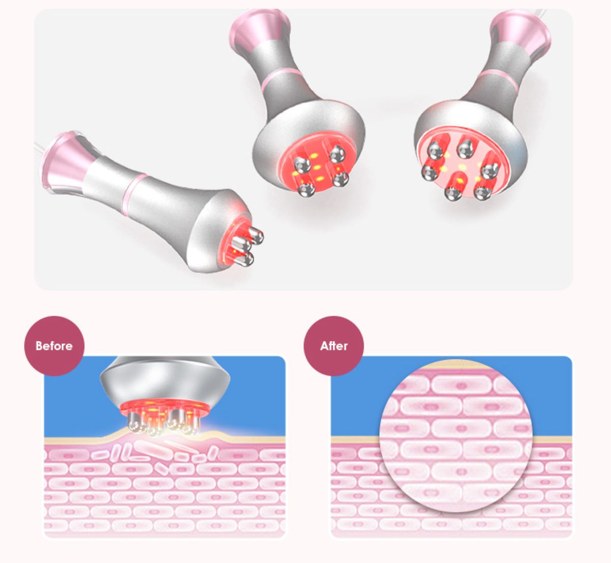 SQ121B Pro, 6in1 80K Cavitation Body Machine, RF Skin Tightening with Laser EMS Microcurrent Pad, Vacuum Negative Pressure Massage Body Contouring Shaping